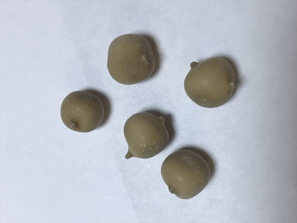 a Hastalarından çıkardığı taşları koleksiyon yaptı