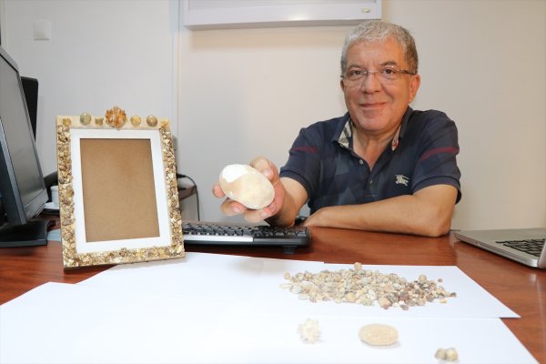 a Hastalarından çıkardığı taşları koleksiyon yaptı