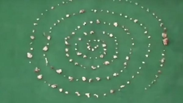 Hindistan'da 526 dişe sahip çocuk