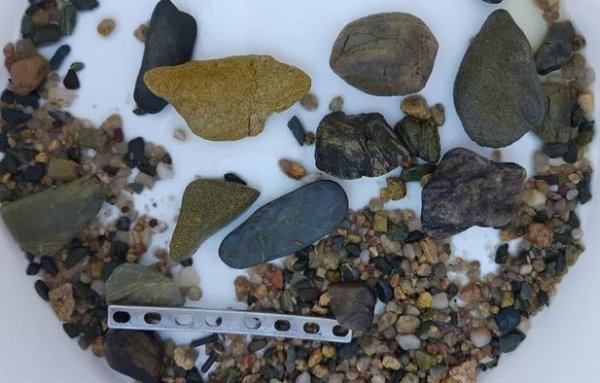 Timsahın midesinden ortopedik plaka çıktı