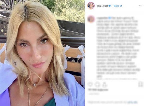 Çağla Şıkel'den makyajsız poz