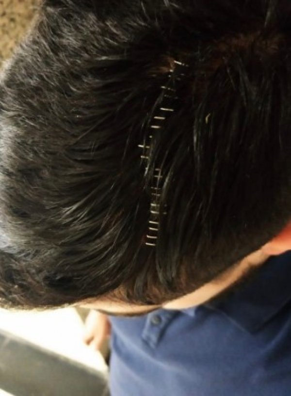 Eminönü'ndeki balıkçıda darp olayına ilişkin 8 gözaltı