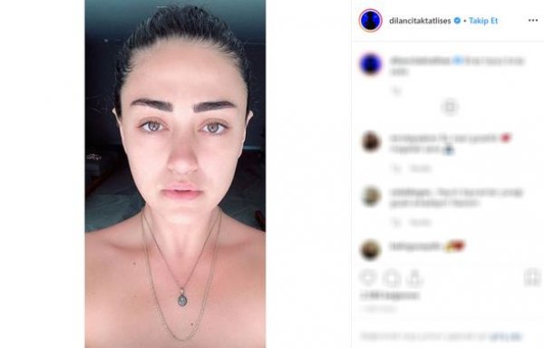 Dilan Çıtak Tatlıses saçlarını topladı