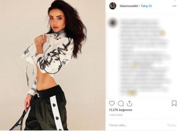 Rus model detoks sonrası hayatını kaybetti