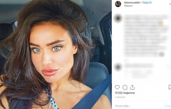 Rus model detoks sonrası hayatını kaybetti