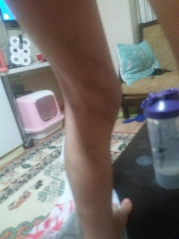 Minik Eymen'in ölmeden önceki son görüntüleri