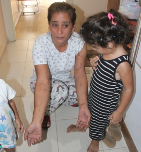 i Adanalı kadın birlikte yaşadığı adam tarafından dövüldü