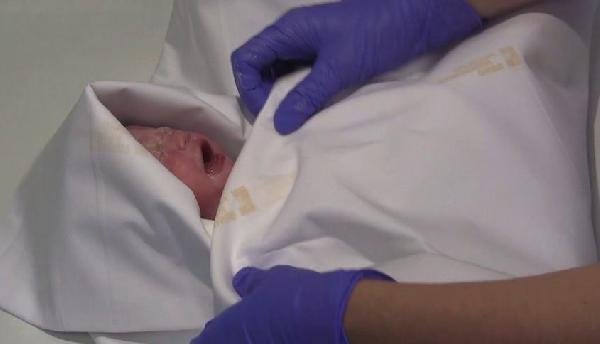 d Çekya'da mucizevi doğum