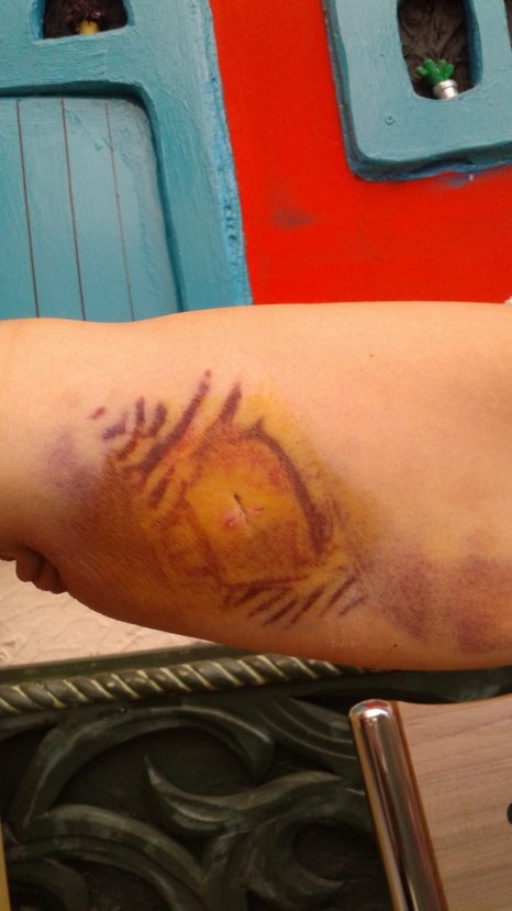 i Eşini 15 yerinden bıçaklayan cani hakkında tutuklama kararı