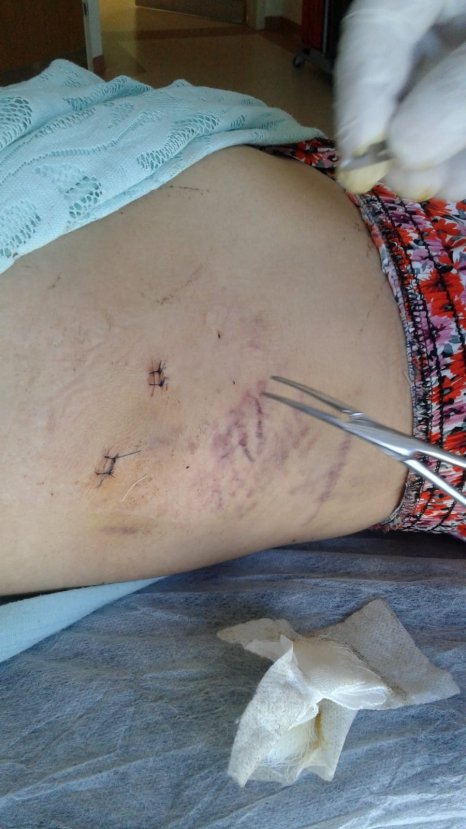 i Eşini 15 yerinden bıçaklayan cani hakkında tutuklama kararı