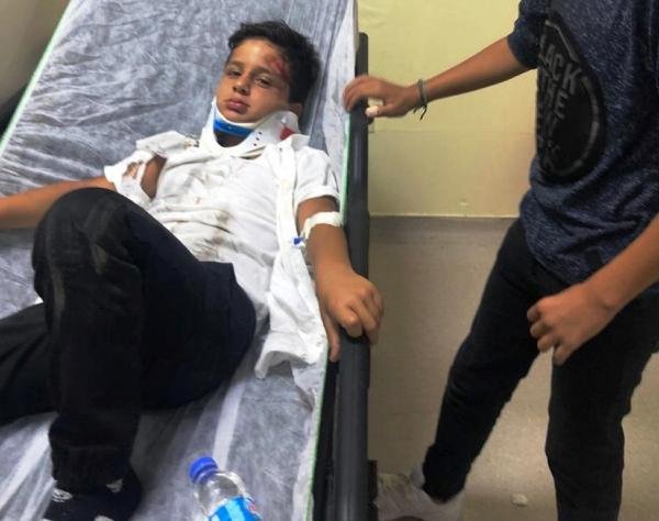 d Okul servisi beklerken ölümden döndüler