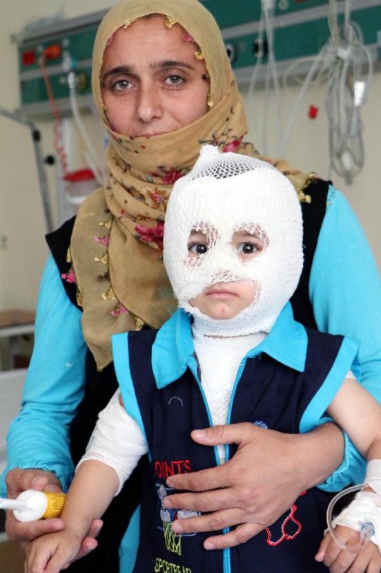 i Erzurum'da 2 yaşındaki çocuğun üzerine kaynar su döküldü