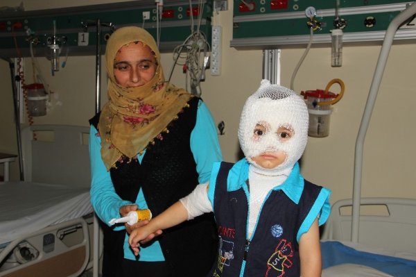 i Erzurum'da 2 yaşındaki çocuğun üzerine kaynar su döküldü