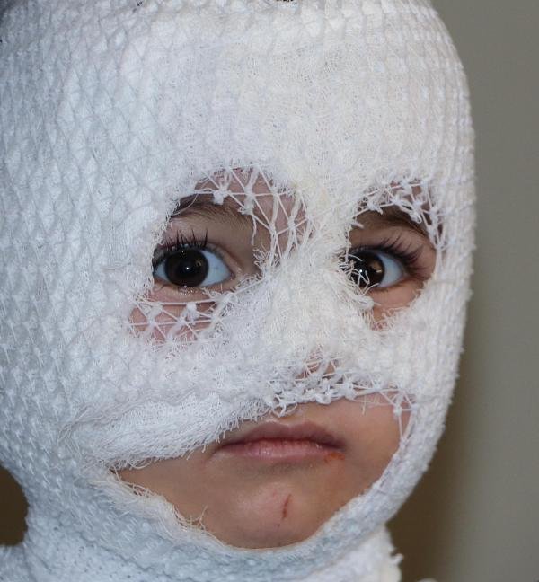 i Erzurum'da 2 yaşındaki çocuğun üzerine kaynar su döküldü