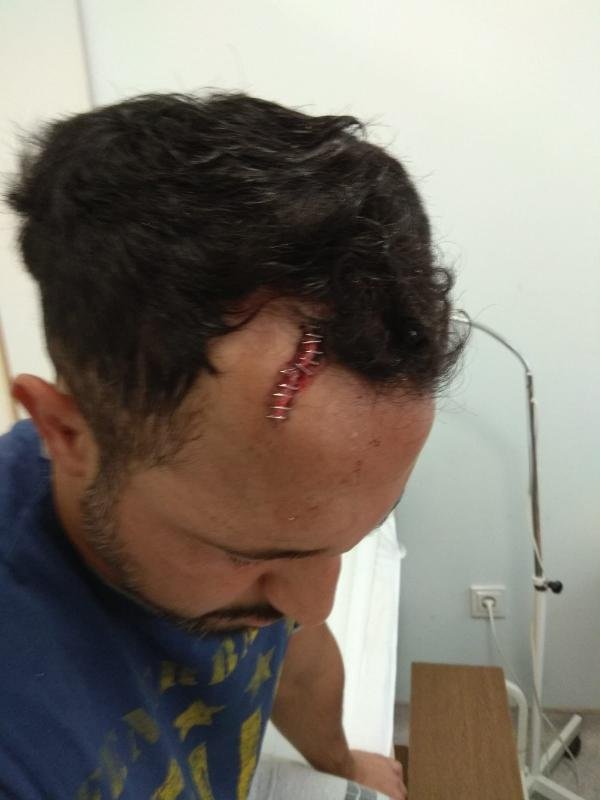 d Pendik'te damat kayınpederinin dudağını parçaladı