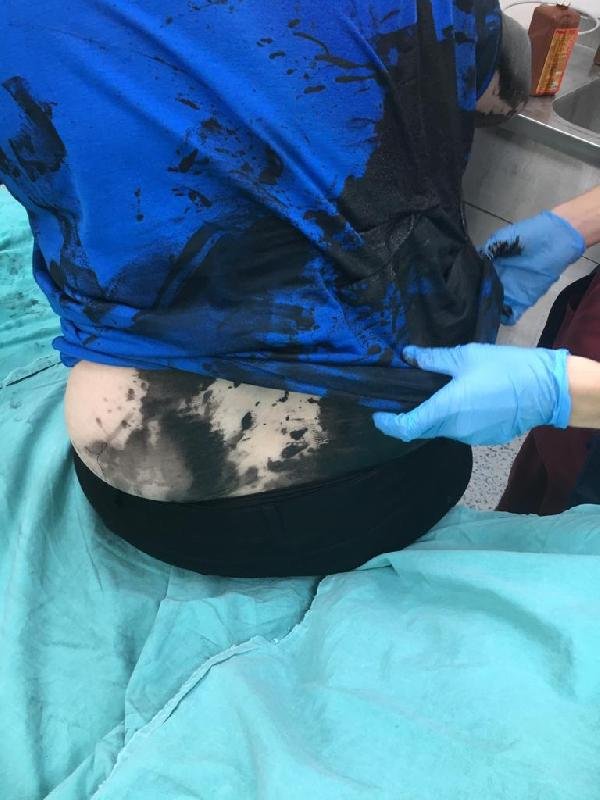 i Adana'da darbedilen müteahhit hastaneye kaldırıldı