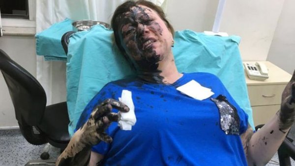 d Adana'da darbedilen müteahhit hastaneye kaldırıldı