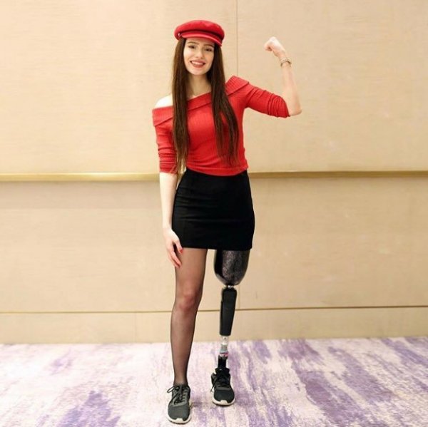 Neslican Tay'ın tedavisi sürüyor