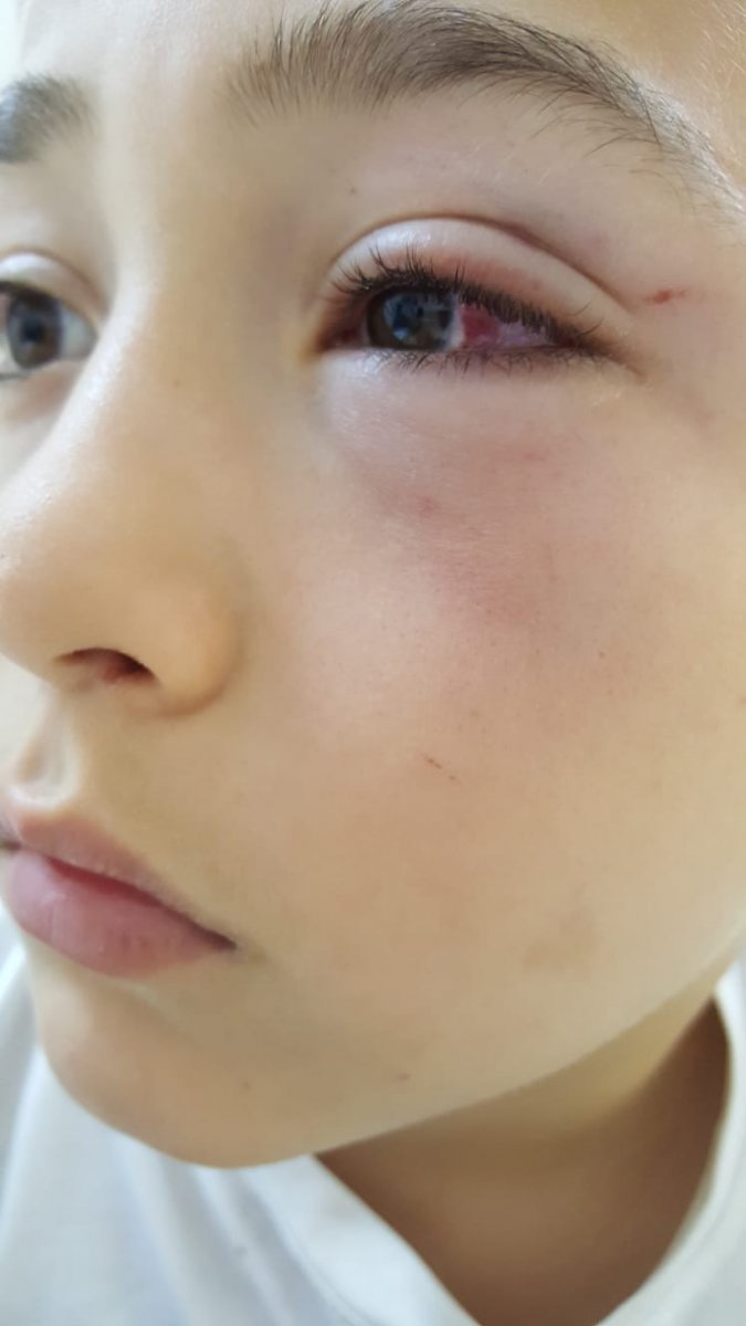 i Oğluyla tartışan 9 yaşındaki çocuğu yumrukla dövdü