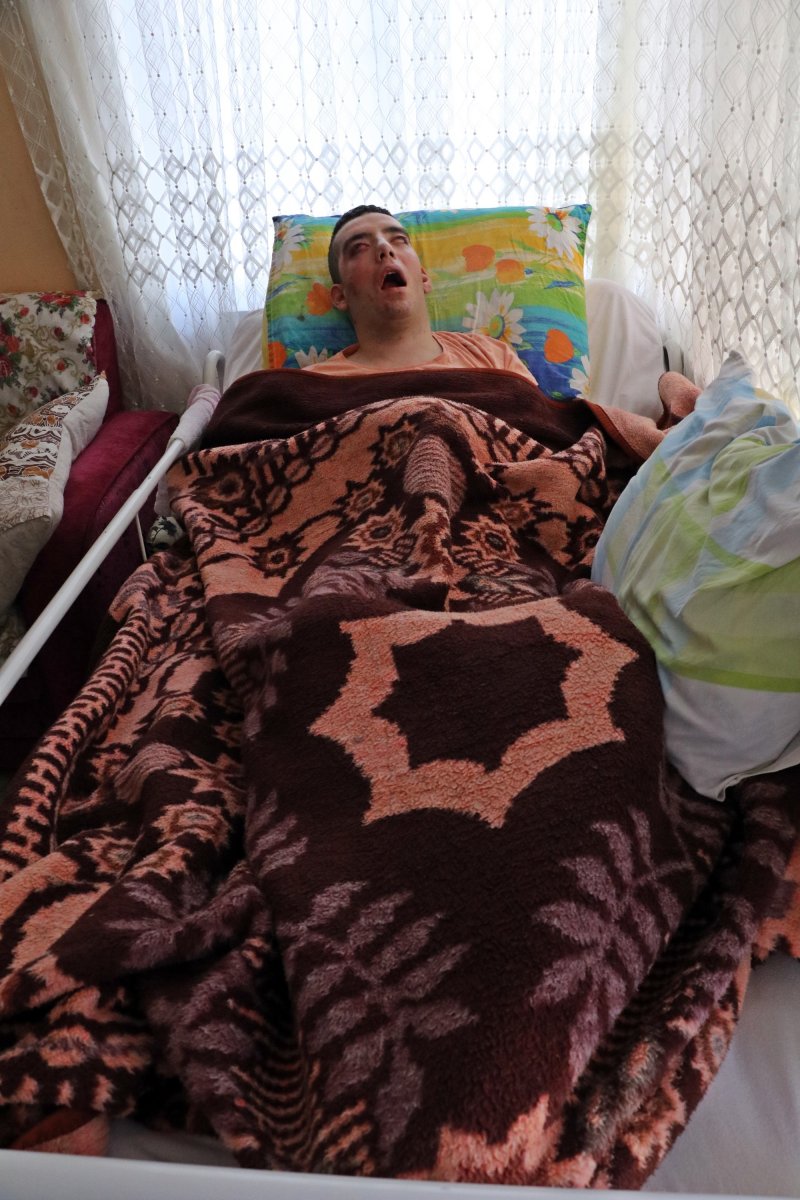 i 28 yaşında hastalığından yatağa mahkum oldu