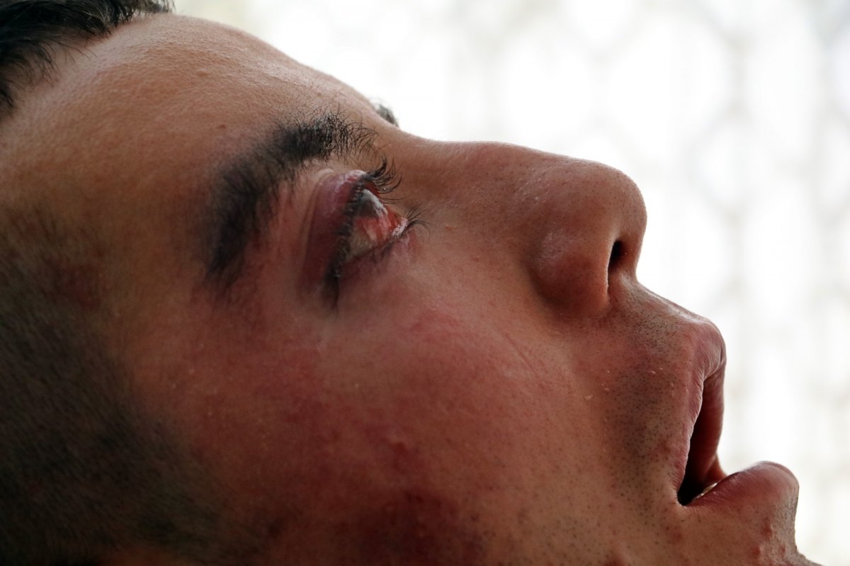 i 28 yaşında hastalığından yatağa mahkum oldu