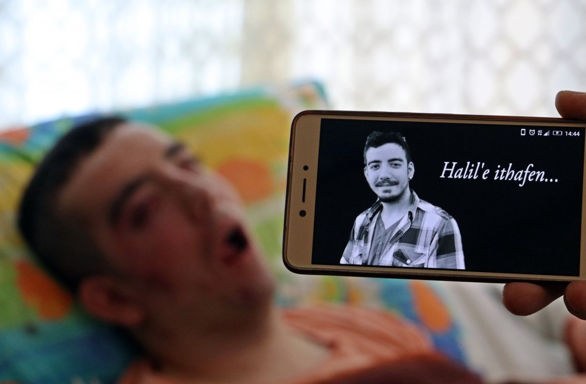 i 28 yaşında hastalığından yatağa mahkum oldu