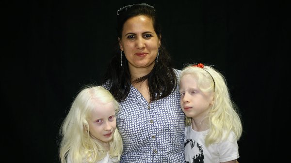 a Adanalı albinolar, 4 mevsim gölge arıyor