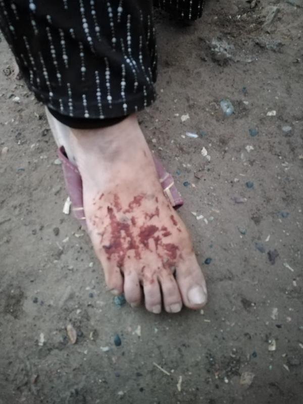 Eşini ve kızını naylon poşetle yaktı