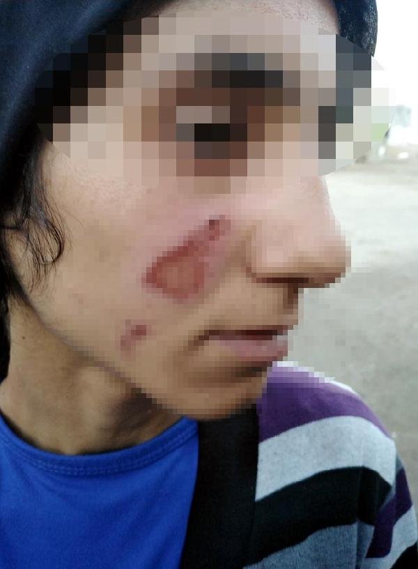 Eşini ve kızını naylon poşetle yaktı