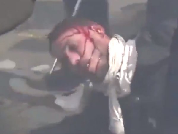 Fransa'da bir eylemci polisler tarafından dövüldü