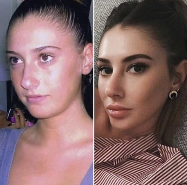 Şeyma Subaşı gıdısını aldırdı