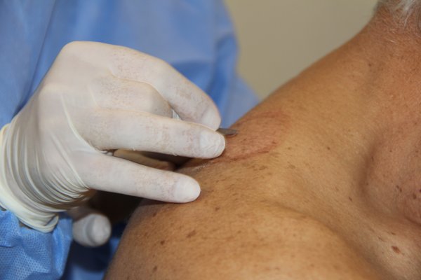 i Mersinliler hacamata yöneldi