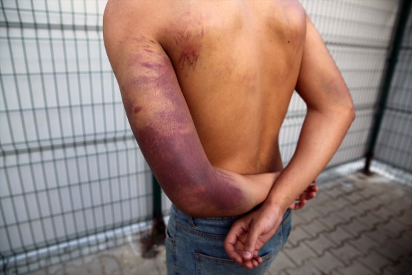 a Yunan askeri göçmenleri silahla dövdü