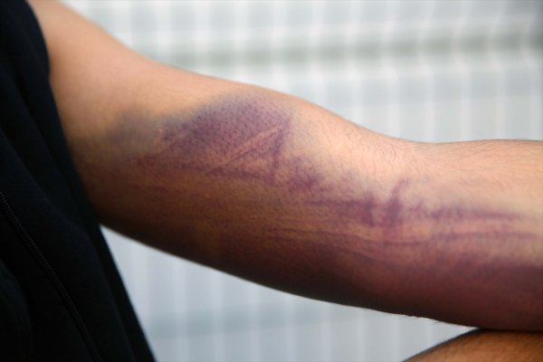 a Yunan askeri göçmenleri silahla dövdü