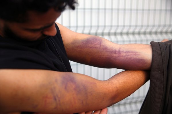 a Yunan askeri göçmenleri silahla dövdü