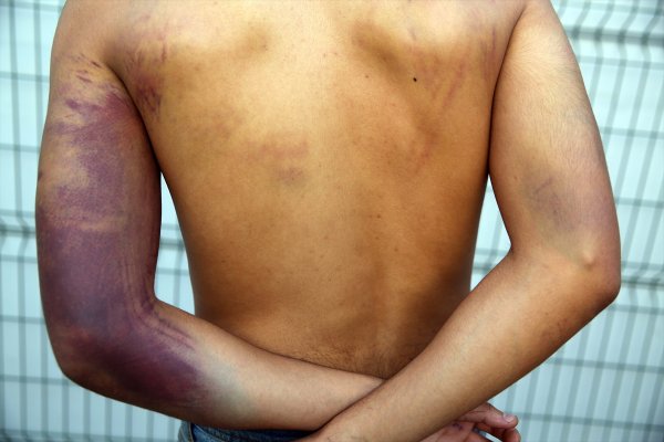 a Yunan askeri göçmenleri silahla dövdü