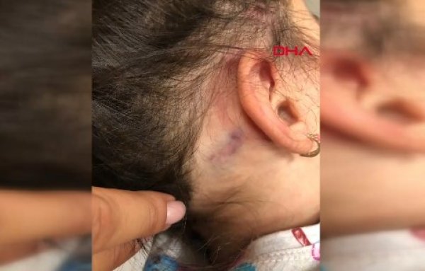 Anaokulunda işkence iddiası