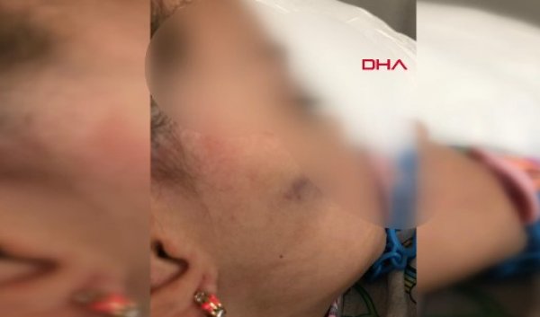 Anaokulunda işkence iddiası