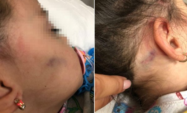 Küçük çocuğun işkence gördüğü anaokulu kapatıldı