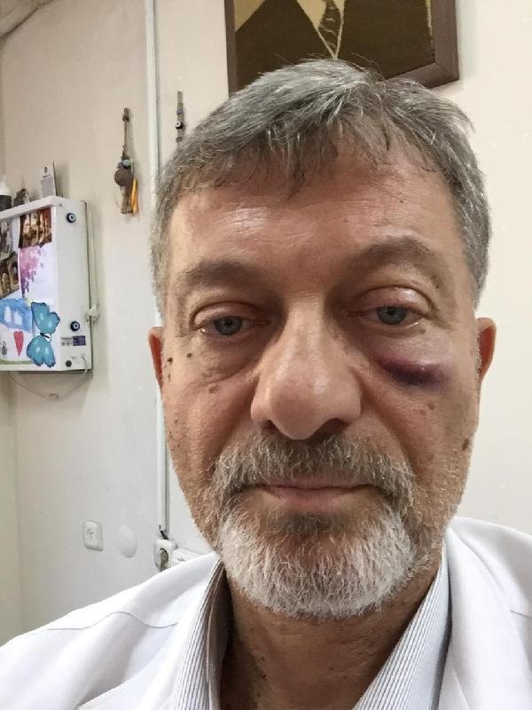 d Doktora kafa atan saldırgan yakalandı