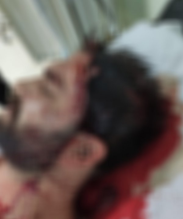 i Topu değiştirmeyen kişiyi öldüresiye dövdüler