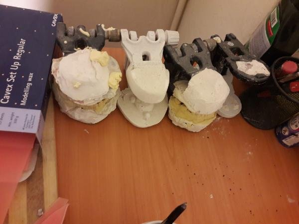 d Sahte dişçi yakalandı, muayenehanesi mühürlendi