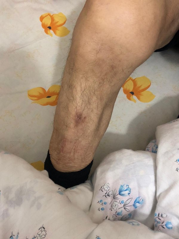 i 93 yaşındaki adam evinde darbedilerek parası çalındı