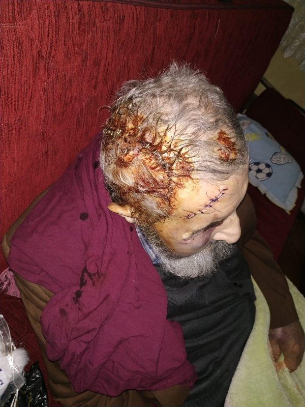 i 93 yaşındaki adam evinde darbedilerek parası çalındı