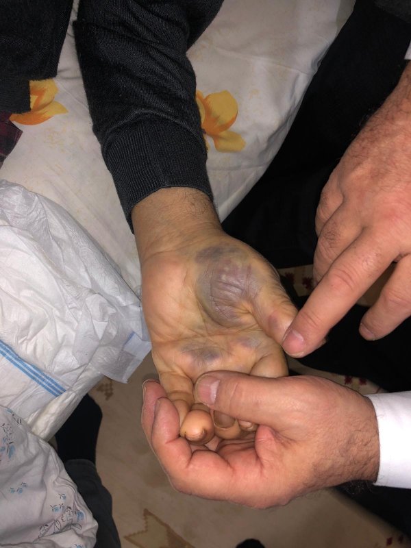 i 93 yaşındaki adam evinde darbedilerek parası çalındı