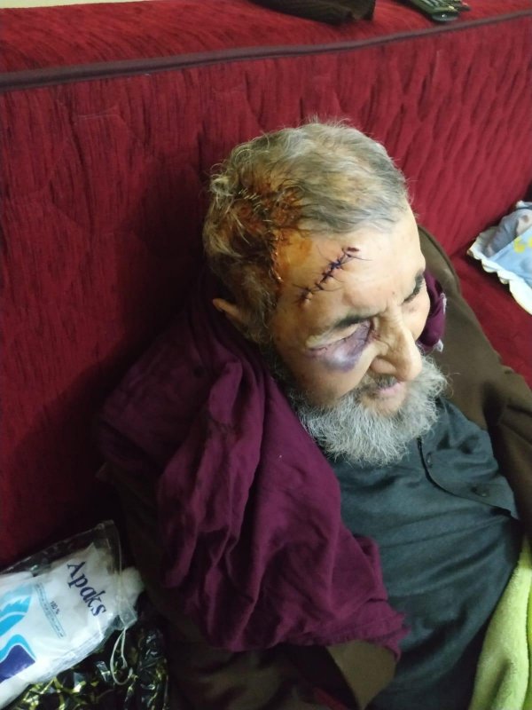 i 93 yaşındaki adam evinde darbedilerek parası çalındı