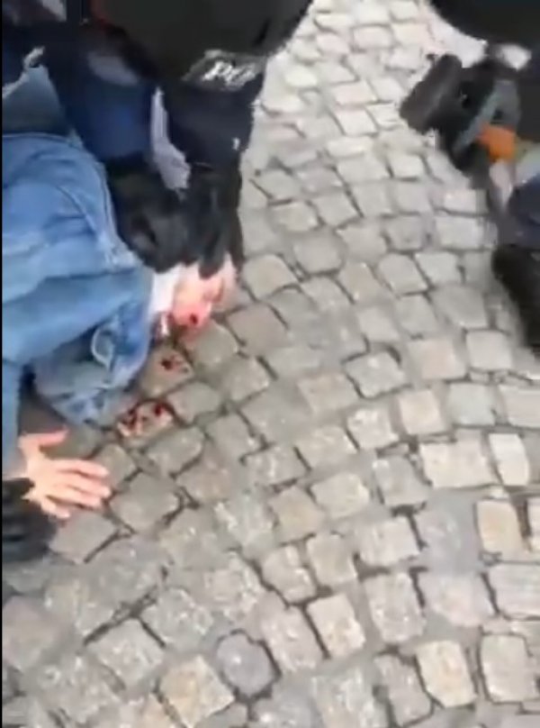 Fransız polisinden göstericiye orantısız güç ile müdahale