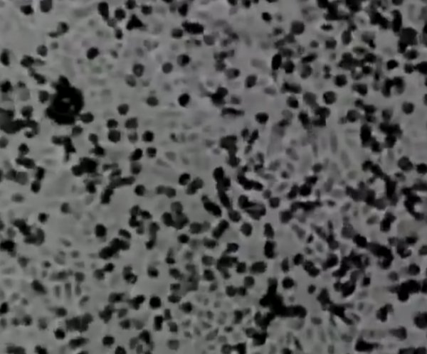 Koronavirüsün çoğalma anı