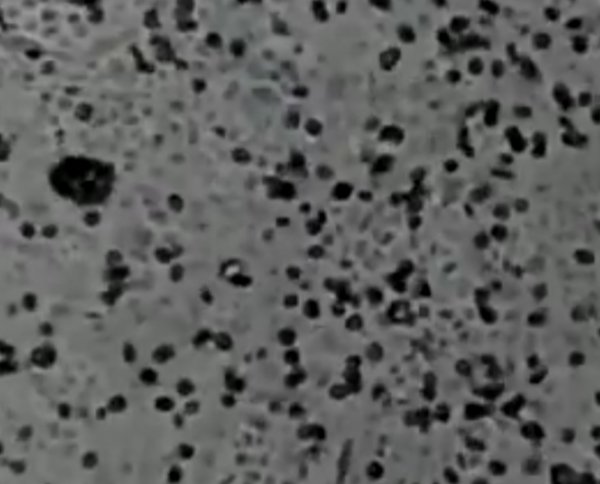 Koronavirüsün çoğalma anı