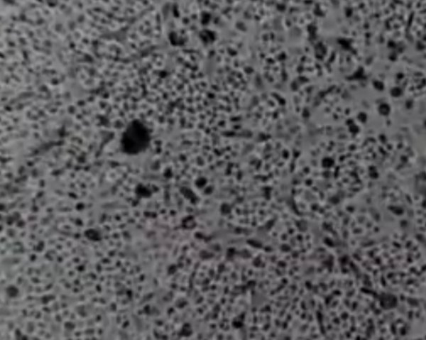 Koronavirüsün çoğalma anı